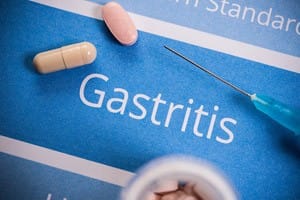 A healthcare professional explaining gastritis treatment methods